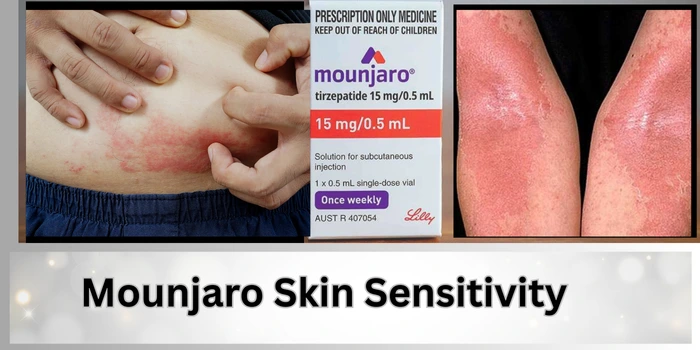 Mounjaro Skin Sensitivity