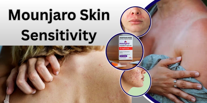 Mounjaro Skin Sensitivity
